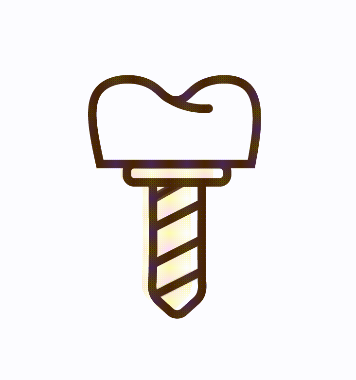 Dental-Implants-Teeth Implants