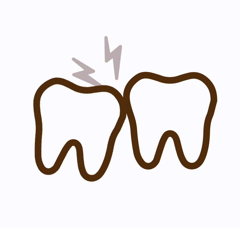 Wisdom-Tooth- Removal